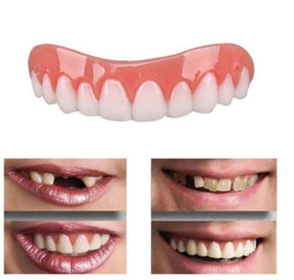 Moldable Resin Tooth Cover with Custom Fit and Stain Camouflage